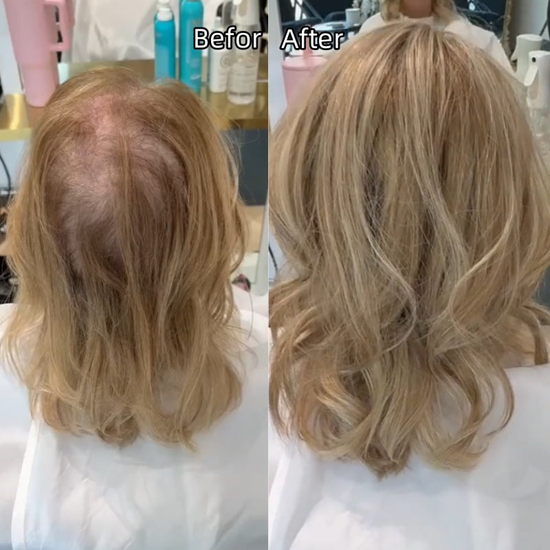 💖Último día: 60% de descuento🌷Nueva peluca de cabello ondulado, ligera y transpirable 2026